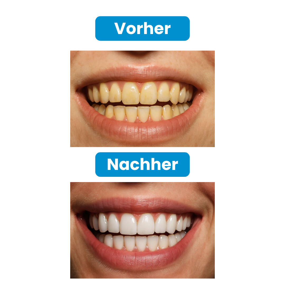 Oralux - U Shape Zahnbürste
