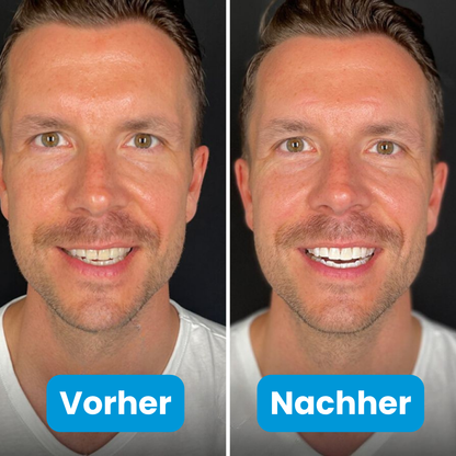 Oralux - U Shape Zahnbürste