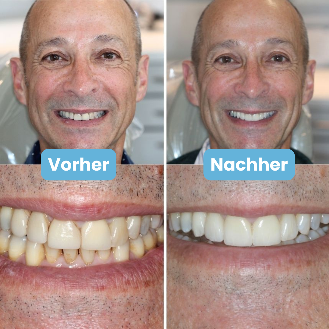 Hydreo - Schluss mit Mundgeruch